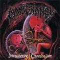 MALIGNANCY / Intrauterine Cannibalism []