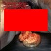 /BOWEL STEW/HIPERMENORREA/PARACO... / Split