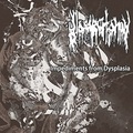 GLOSSECTOMY / Impediments from Dysplasia []