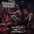 MYOCARDIAL INFARCTION / Cannibalistic Gore of Grotesque []