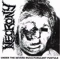NECRONY / Under the Severe Mucu-Purulent Pustule (2CD) []