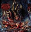 /UMBILICAL ASPHYXIA / Rampant Infantile Strangulation