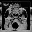 /INTESTINAL DISGORGE / Everlasting Fractal Nightmare