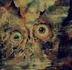 /TERATOMA / Purulent Manifestations