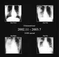 Martyrdom / Ululate / Heartless / w348? - Black Metal Is PlaguexiBlack Metal split) (Áj []
