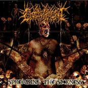 ENGORRIMENT / Spreading the Sickness