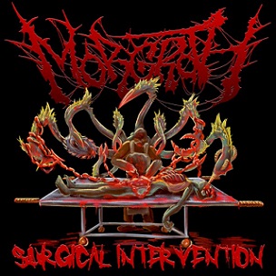 MORGROTH / Surgical Intervention