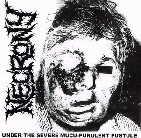 NECRONY / Under the Severe Mucu-Purulent Pustule (2CD)