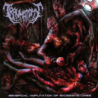 TRAUMATOMY / Beneficial Amputation of Excessive Limbs