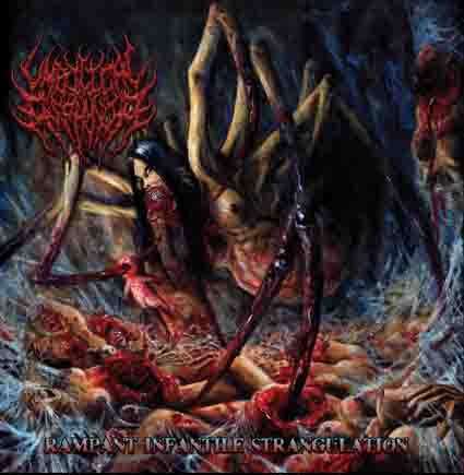 UMBILICAL ASPHYXIA / Rampant Infantile Strangulation