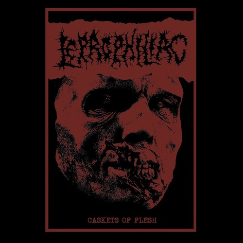 LEPROPHILIAC / Caskets of Flesh