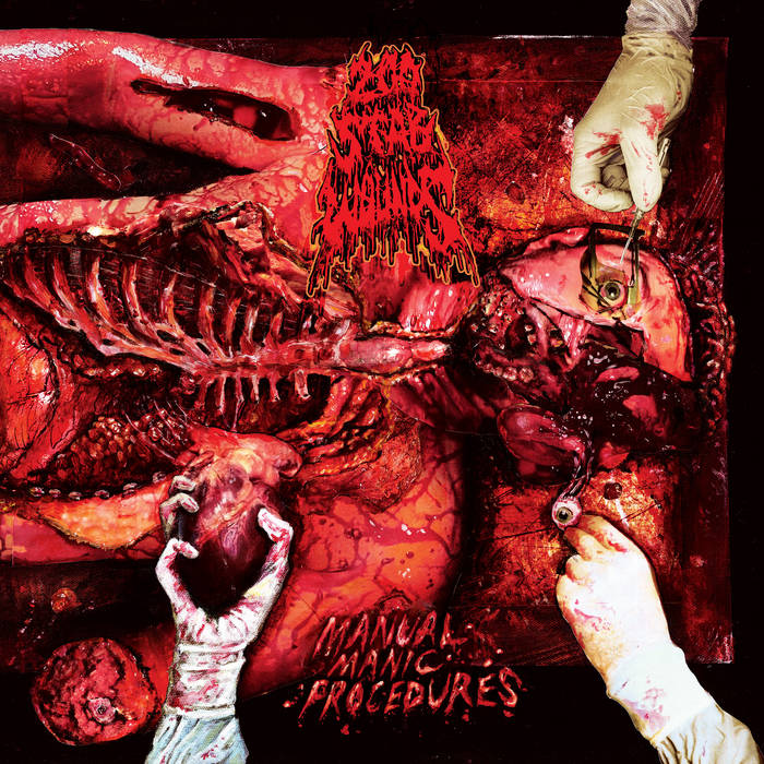 200 STAB WOUNDS / Manual Manic Procedures